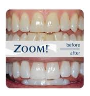 zoom teeth whitening