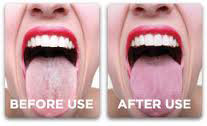 before after tongue scraper