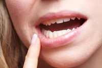 What Causes Receding Gums