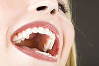 What are the different types of teeth?