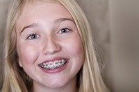 11 Easy Tips to Keep Your Teeth White With Braces