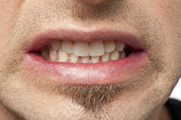 The Daily Grind: Teeth Clenching During the Day and What to Do About It