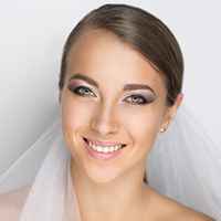 wedding teeth whitening