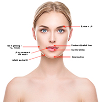 dental botox