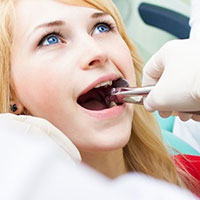 wisdom teeth foods