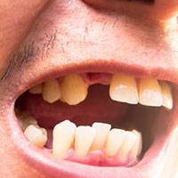 regrow teeth