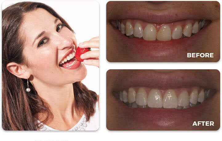 Water Tower Dental Care before and after treatment