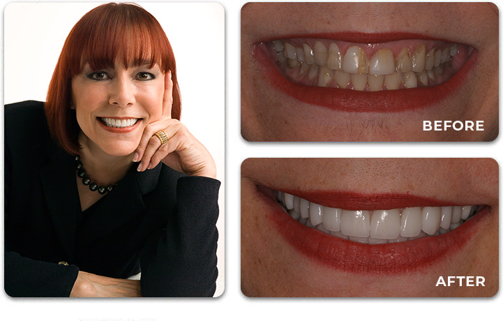 Water Tower Dental Care before and after treatment