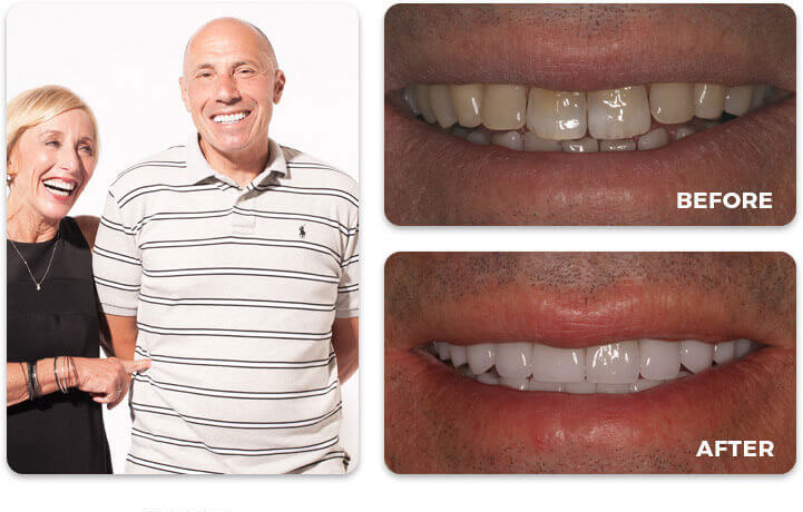 Water Tower Dental Care before and after treatment