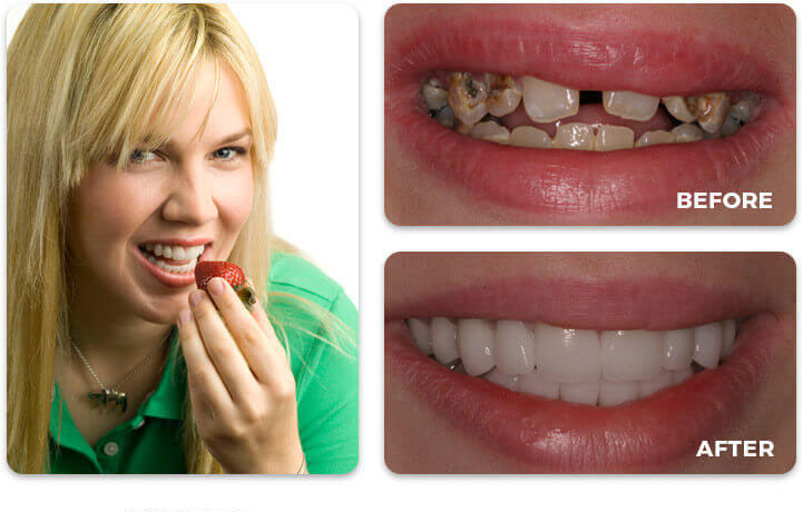 Water Tower Dental Care before and after treatment