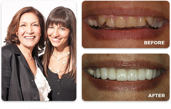 Water Tower Dental Care before and after treatment