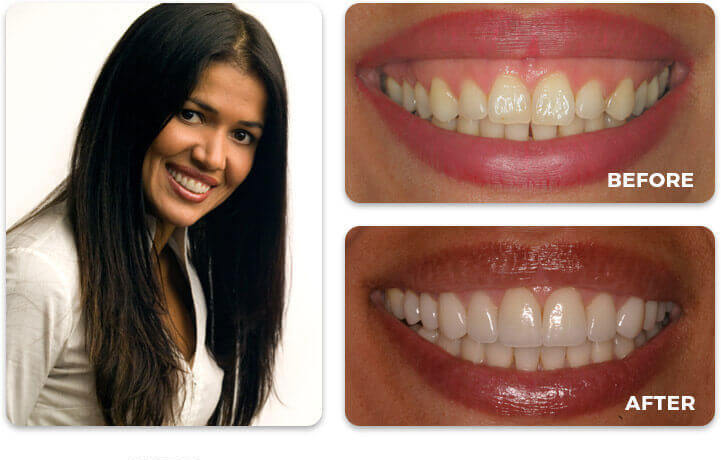 Water Tower Dental Care before and after treatment