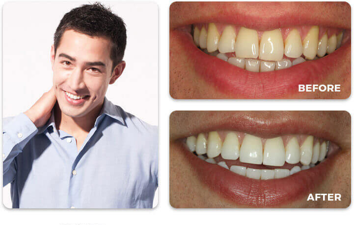 Water Tower Dental Care before and after treatment