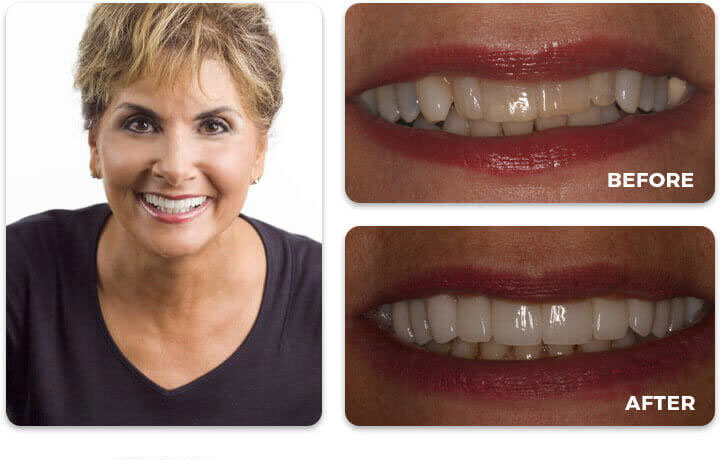 Water Tower Dental Care before and after treatment