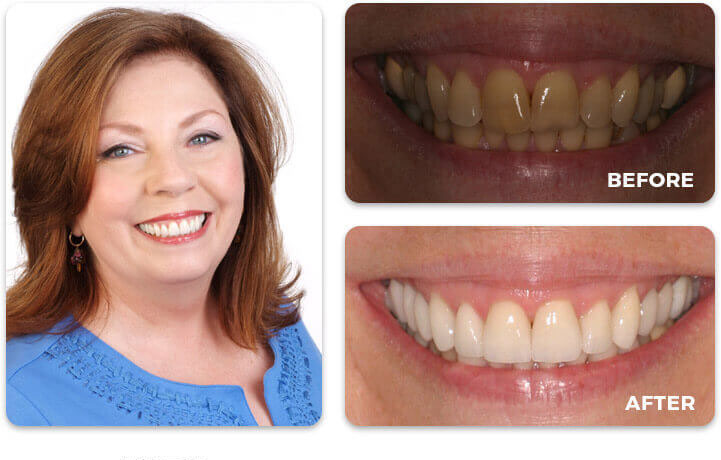 Water Tower Dental Care before and after treatment
