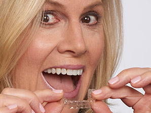 Invisalign treatment