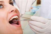 Busting 6 Common Dental Myths