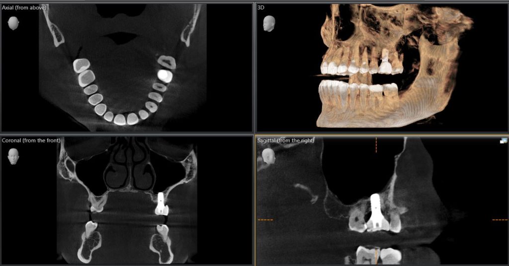 CBCT imaging