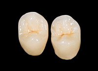 Do CEREC One-Visit Crowns Actually Work?