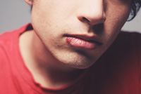 Does Laser Treatment Work for Cold Sores On Your Lips?