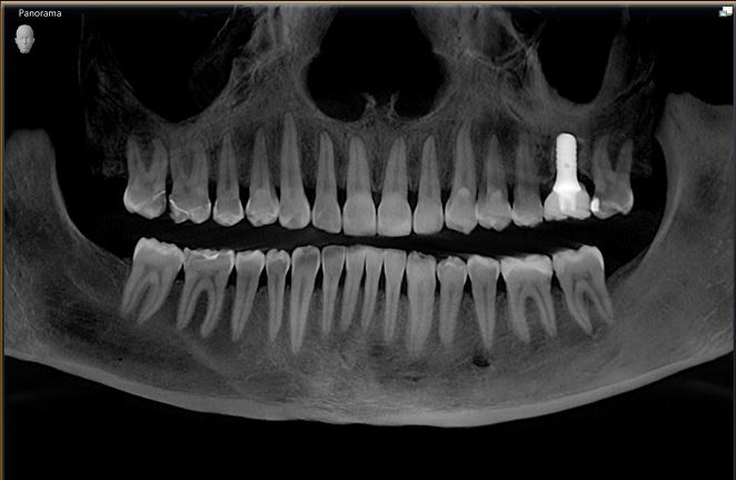dental x-rays