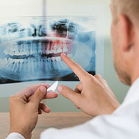 dental x-rays
