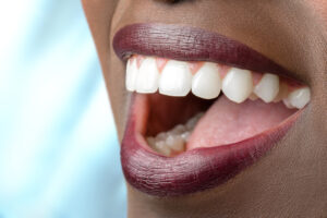 woman with mouth open smiling